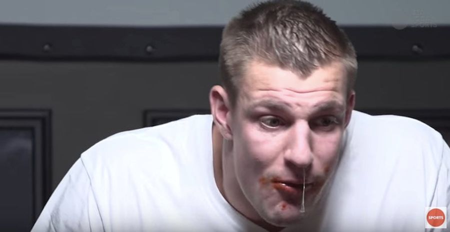 Gronk Eats Wings, Suffers, Drips Snot