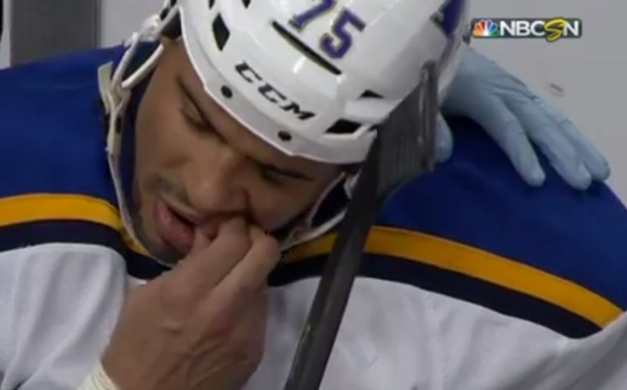 Ryan Reaves Pulls Out His Own Tooth