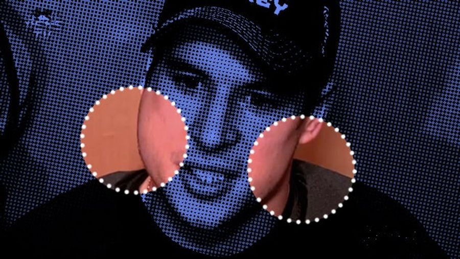 Why The NHL Lost Control Of Its Mumps Outbreak