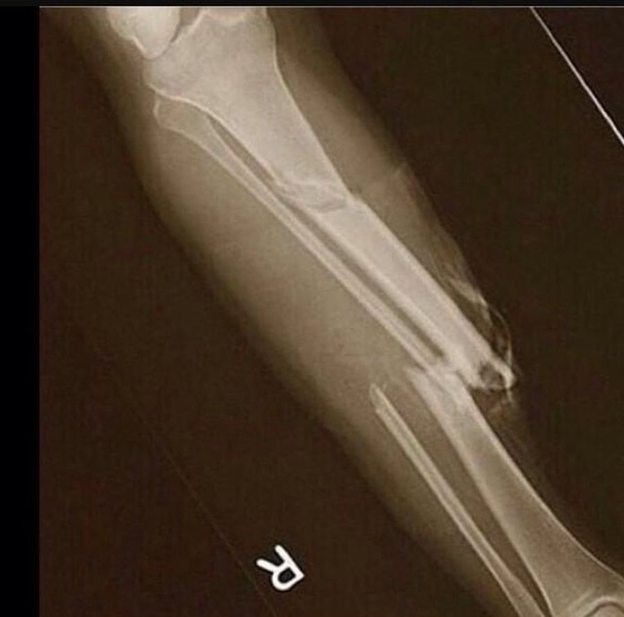 That Image Of "Paul George's X-Ray" Isn't Really His