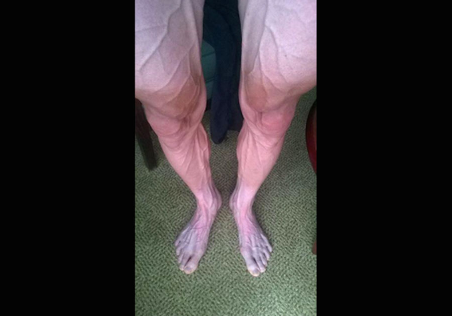 This Is What Your Legs Look Like After A Stage Of The Tour de France