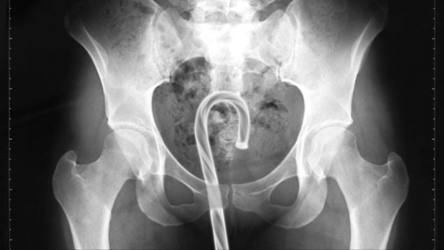 What Did We Get Stuck In Our Rectums Last Year?<em></em><em></em>