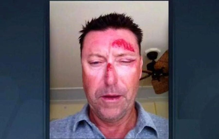 Witness: Robert Allenby Hurt Himself After A Trip To The Strip Club