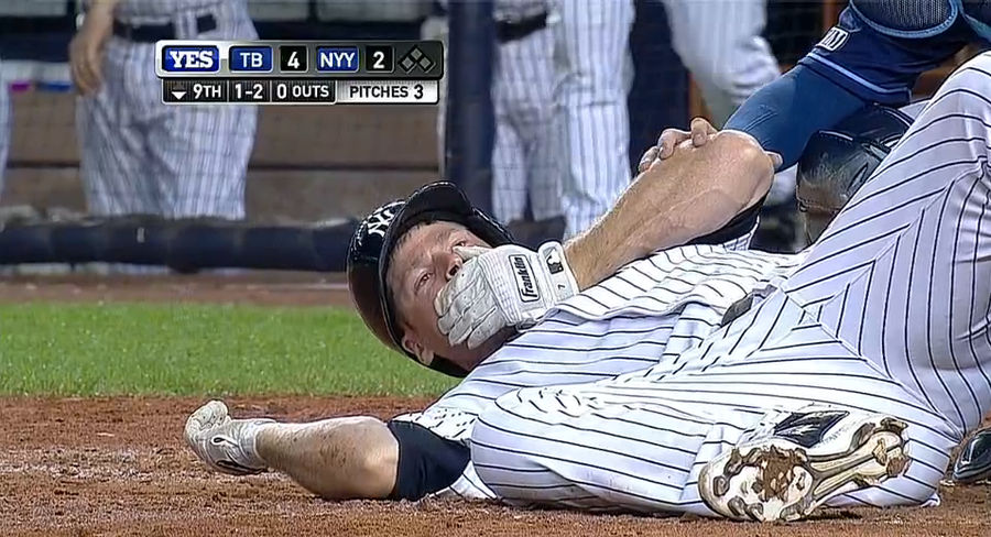 Chase Headley Takes A Fastball To The Chin