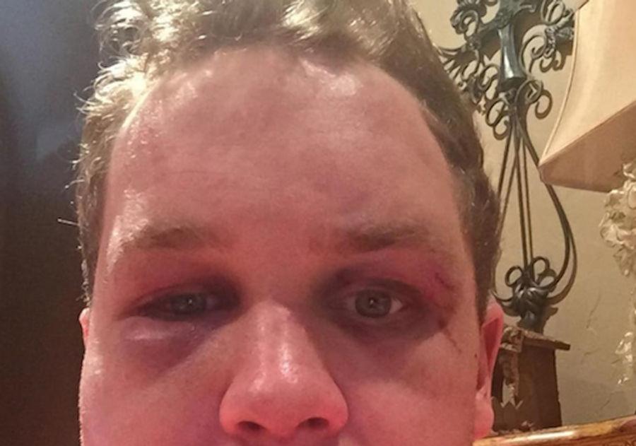 MLB Prospect&#39;s Lawyer Releases Graphic Photos After Alleged Assault