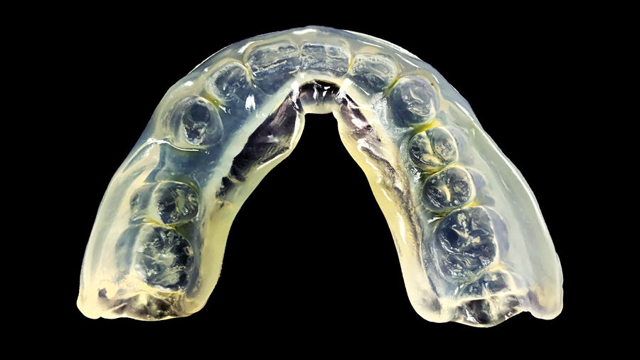 Confessions Of A Tooth Grinder
