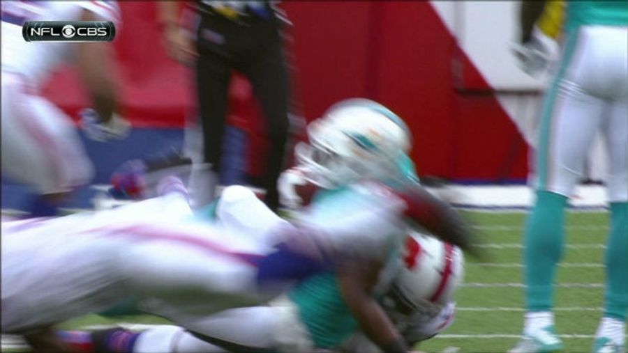 Knowshon Moreno's Elbow Is Not Acting Like An Elbow
