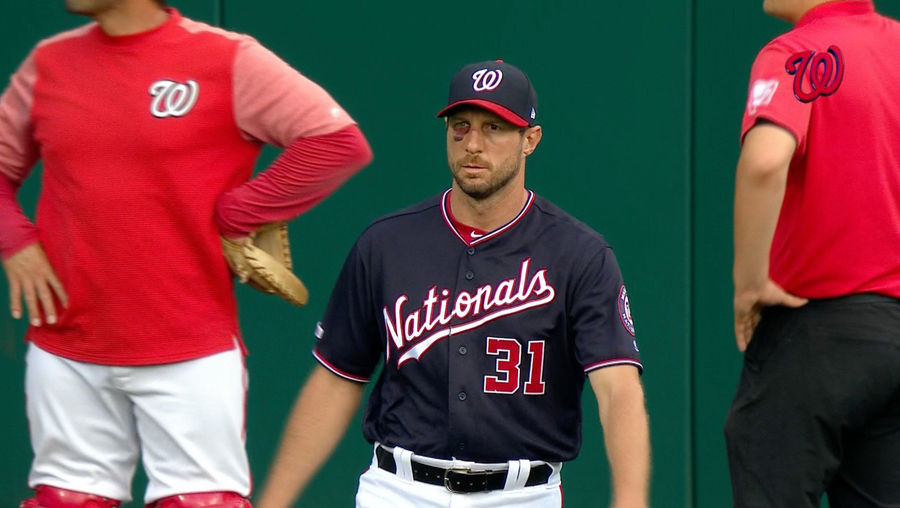 Wild Man Max Scherzer Is Pitching With A Huge Shiner One Day After Breaking His Nose [UPDATE]