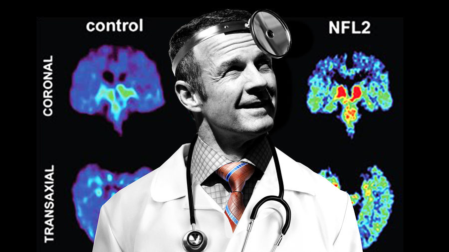 Merril Hoge Doesn&#39;t Want You To Use Your Brain