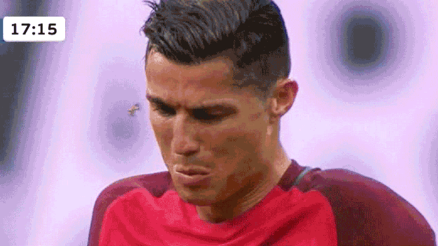 Ronaldo Hurt; Assaulted By Moth