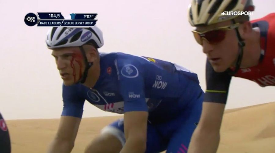 Asshole Pro Cyclist Booted From Race After Punching Opponent In The Face