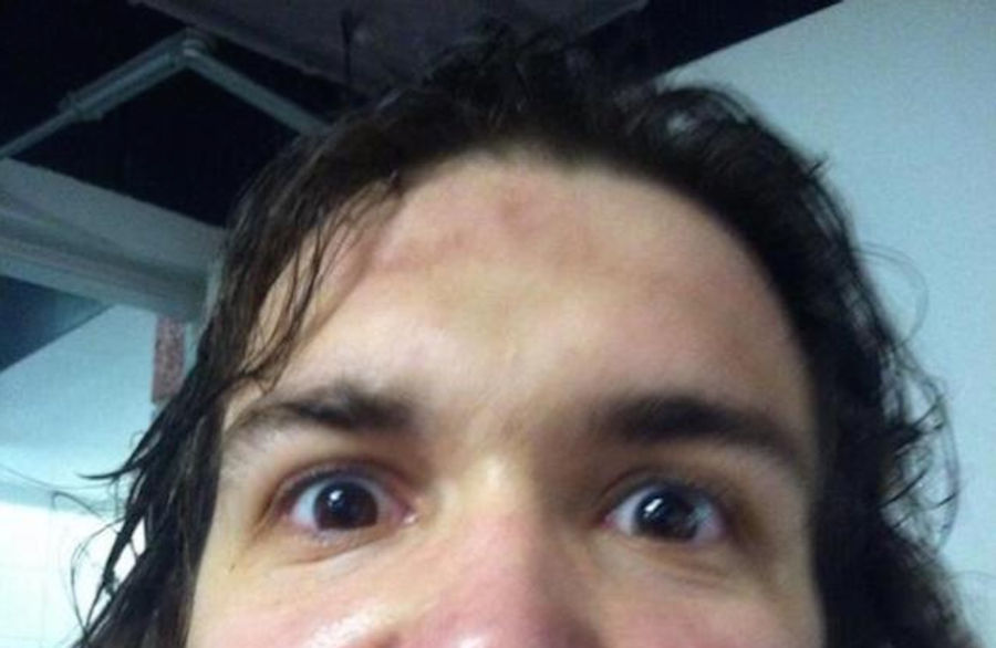 Red Wings Prospect Takes Puck To Mouth, Tweets Photo Of Aftermath
